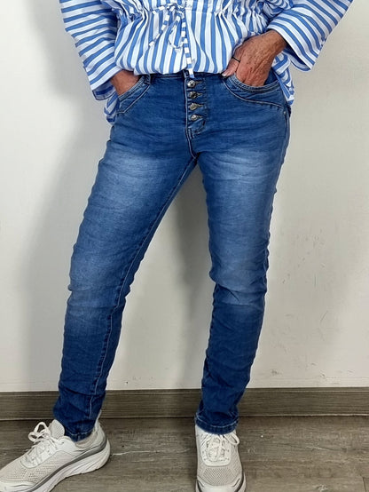 Trendige High-Waist-Jeans mit Knopfleiste – Komfort trifft Style